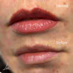 Semi-permanent lip blush revitalizing pale lips with a natural pop of colour in Exeter, UK