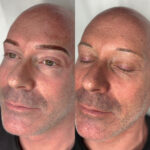 Balanced semi-permanent brows for men, enhancing symmetry and facial features in Exeter