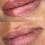 Exeter lip blush – subtle lip colour enhancement for daily wear