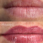 Natural healed lip blush Devon – soft pink lip colour